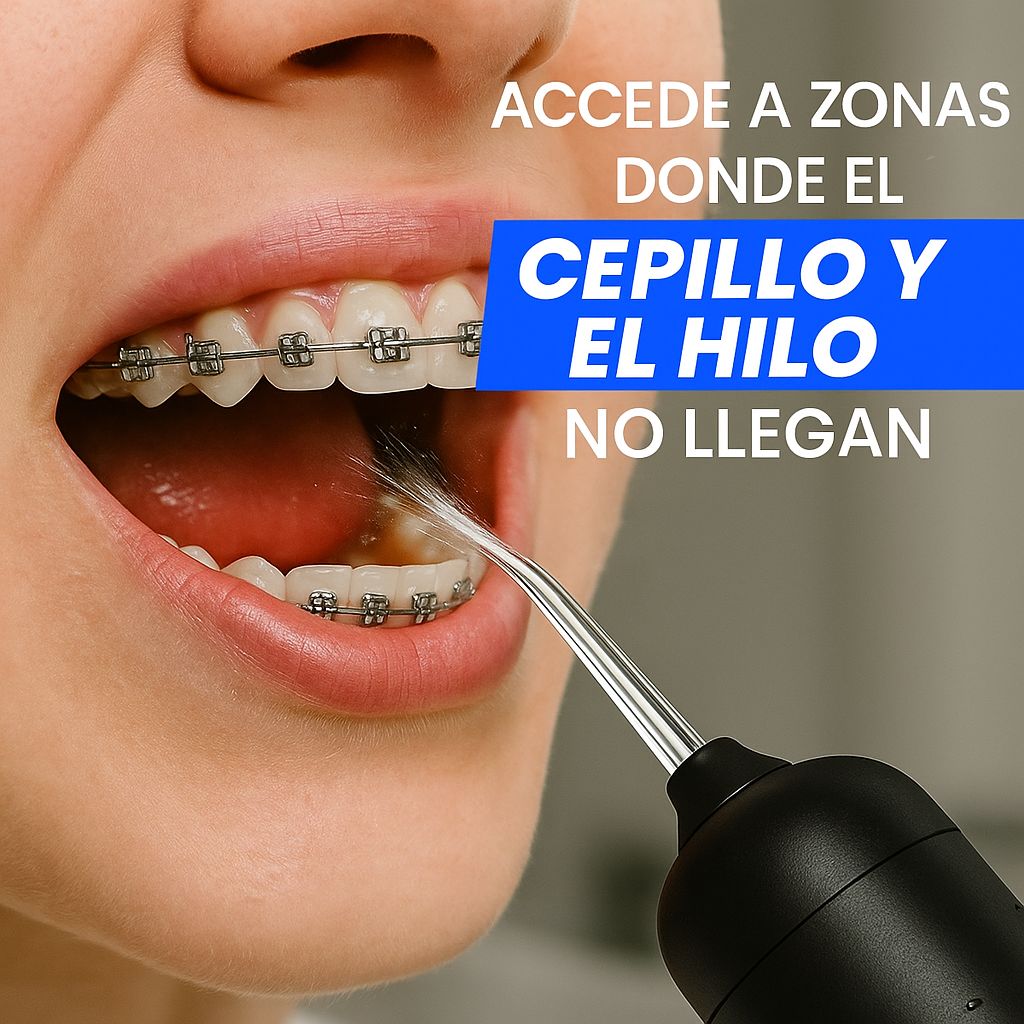 Elimina el 99.9% de la placa y el sarro en solo 1 minuto al día con el Irrigador Dental 4B