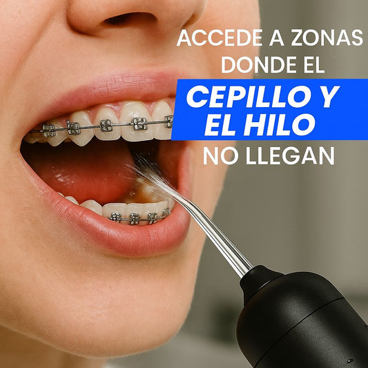 Elimina el 99.9% de la placa y el sarro en solo 1 minuto al día con el Irrigador Dental 4B