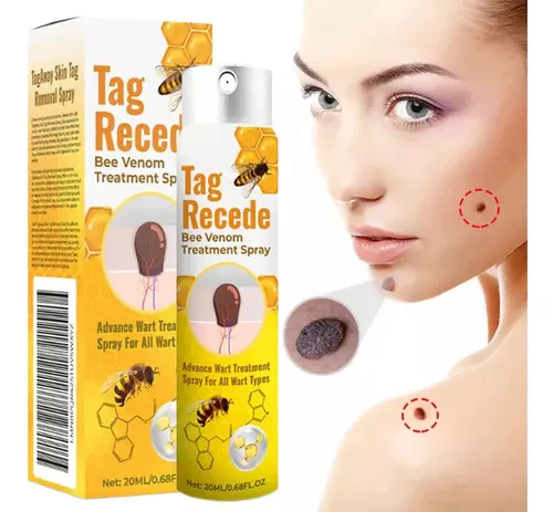 Tag Recede Eliminador de verrugas - 50%OFF - ECU